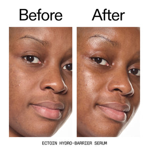 Before and after of customer using Ectoin Hydro-Barrier Serum
