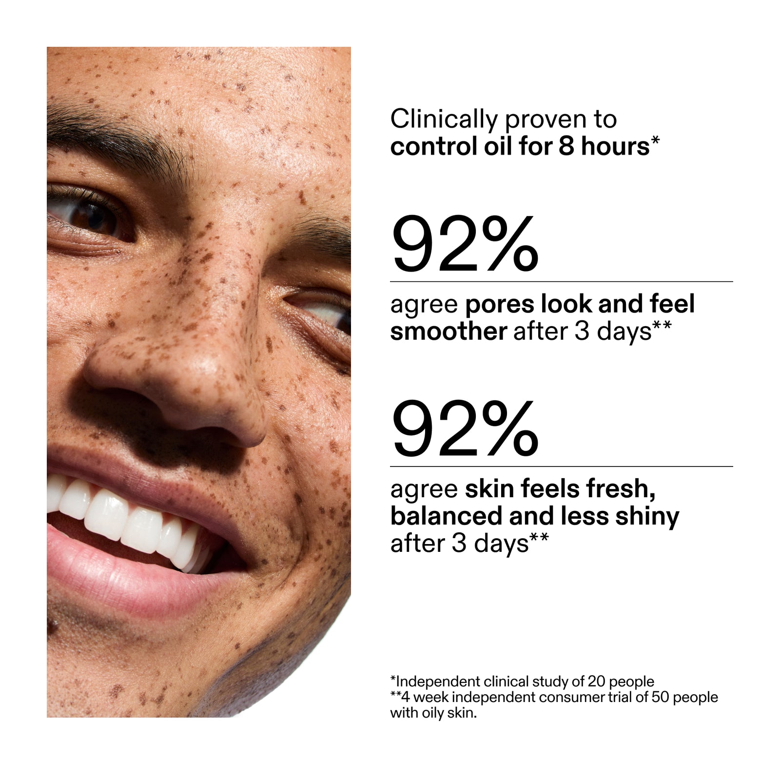 20% Niacinamide Serum Oil Control Serum INKEY USA