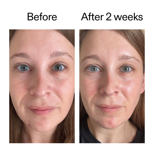 Exosome Hydrating Serum for Glowing Radiant Skin | The INKEY List