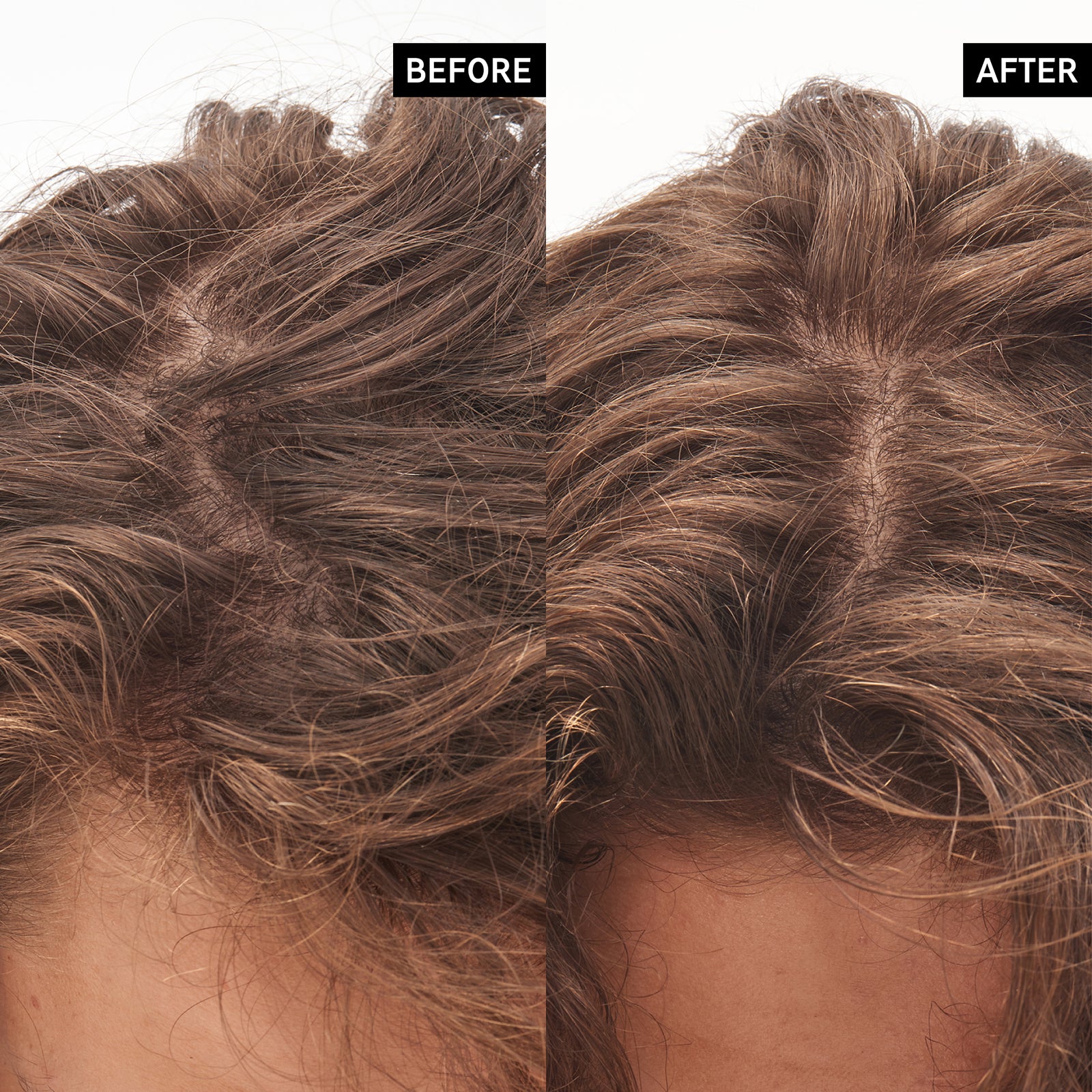 before and after of using Glycolic Acid Exfoliating Scalp Scrub