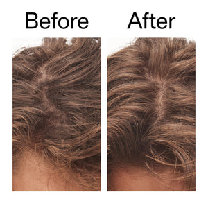 Before and after comparison of using Glycolic Acid Exfoliating Scalp Scrub