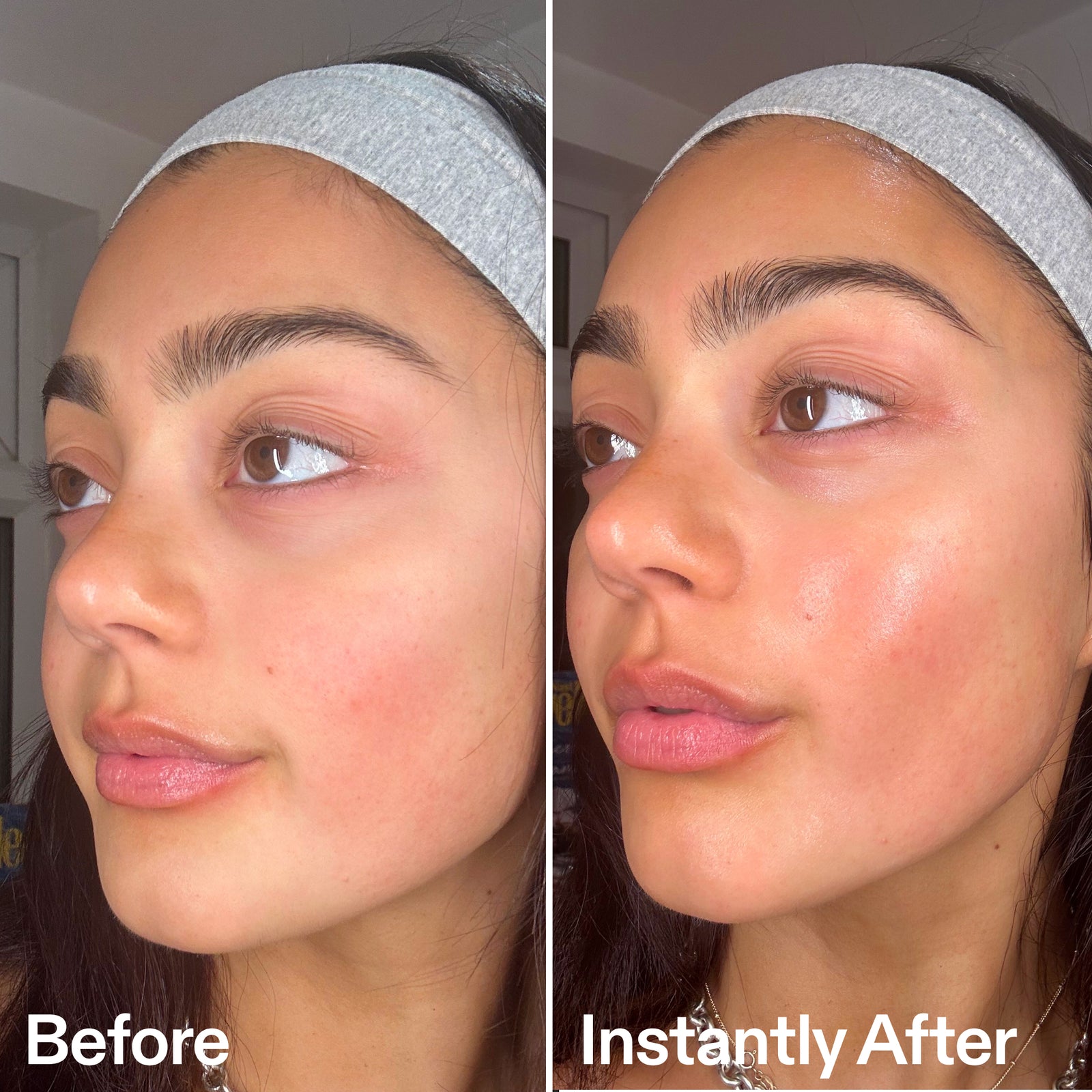 Before and after comparison of a woman's face with visible skin concerns.