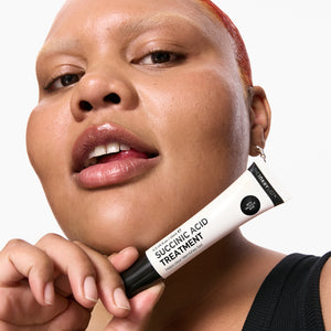 Model holding a tube of Succinic Acid Acne Treatment