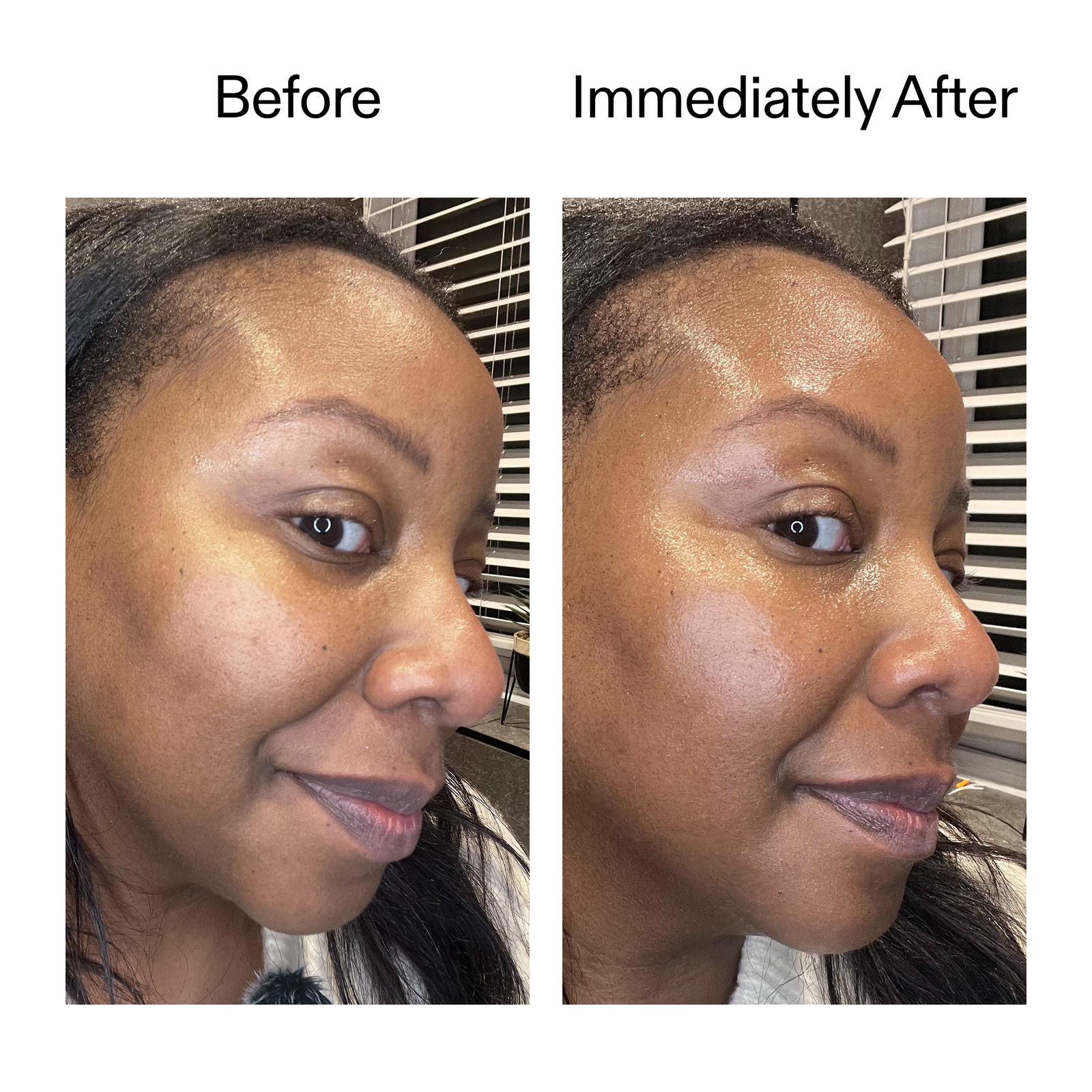 Plant-Derived Cica Exosome Serum | 6-in-1 Glow & Renewal | The Plant-Derived Cica Exosome Serum | 6-in-1 Glow & Renewal | The