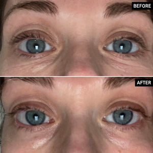 Retinol Eye Cream before and after results