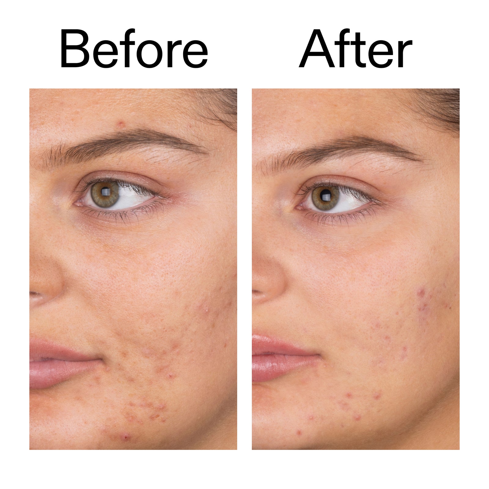 Supersize Salicylic Acid Cleanser Duo