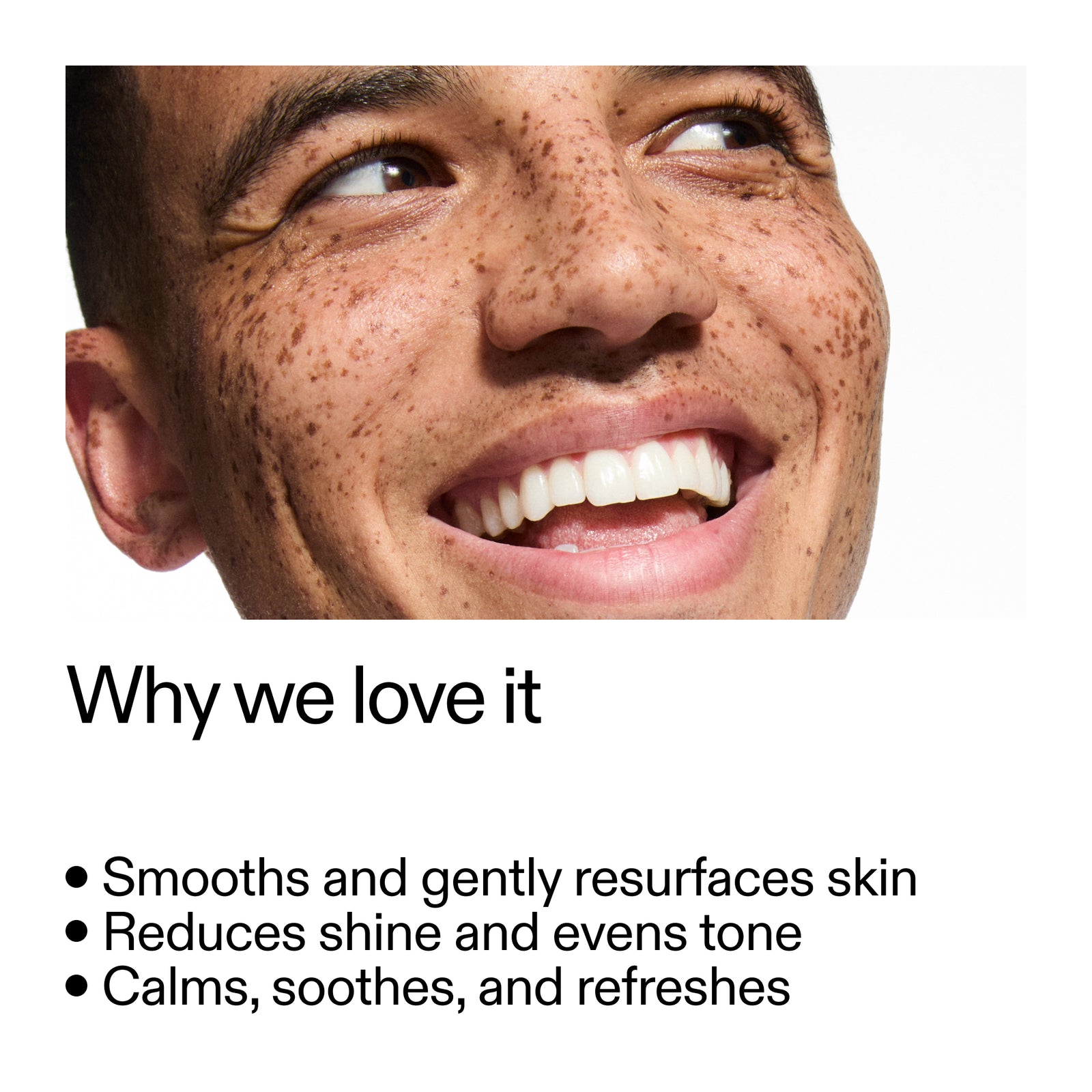 Close-up of a person's face with text highlighting 1% Retinol Serum benefits on a white background