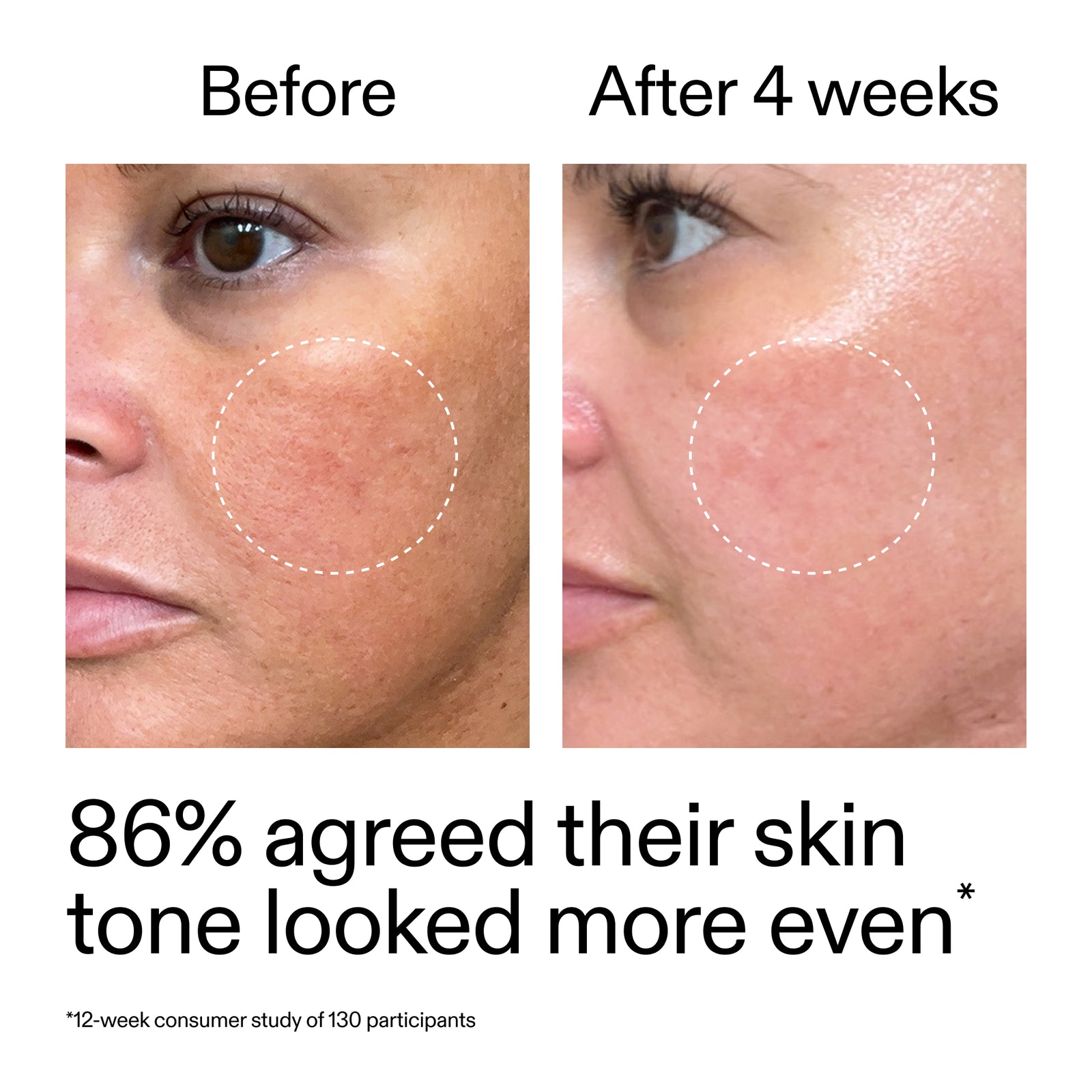 Before and after comparison of skin tone with text indicating improvement and study details.