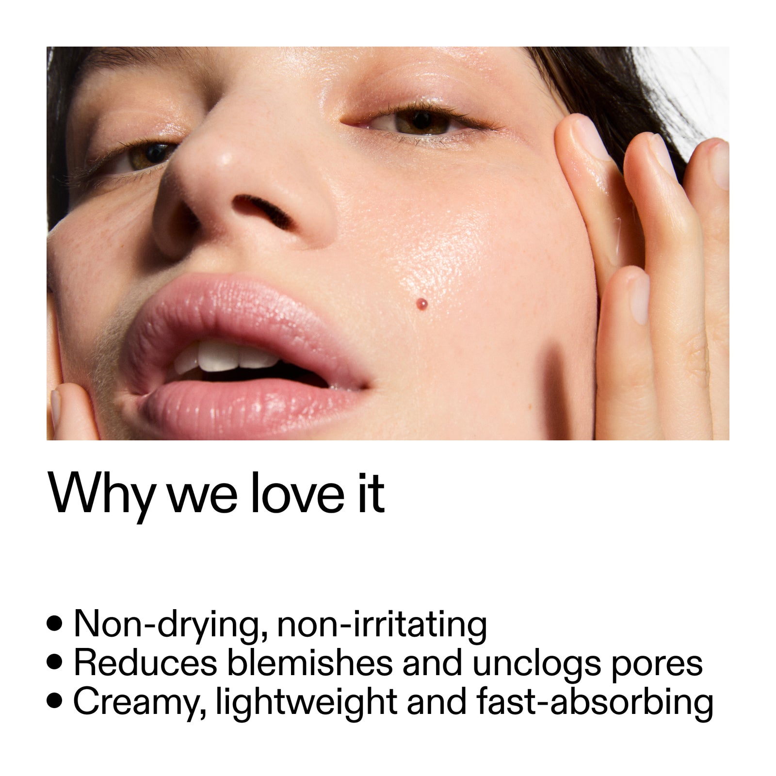 Close-up of a person's face with text highlighting Succinic Acid Acne Treatment benefits