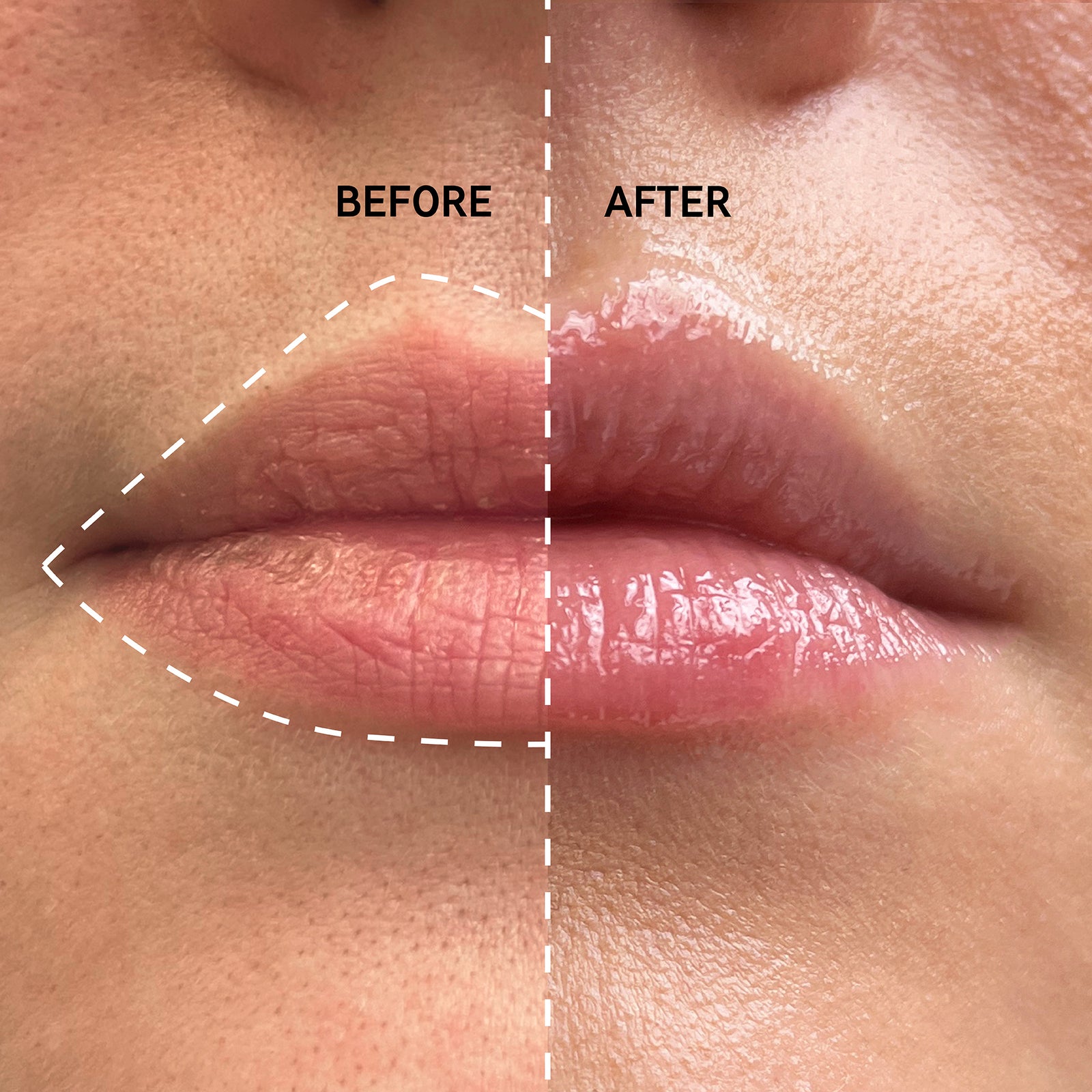 Two images of a pair of lips, put side by side to show the different after using Tripeptide Plumping Lip Balm for 2 weeks.