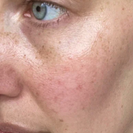 Close-up of a person's cheek and eye area showing natural skin texture, freckles, and a light pink blush tone.