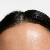 Close-up of a black hairline and part of a person's forehead against a light gray background.