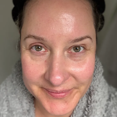 A close-up portrait of a woman's face showing her skin texture and complexion, wearing a gray textured fleece collar or sweater.