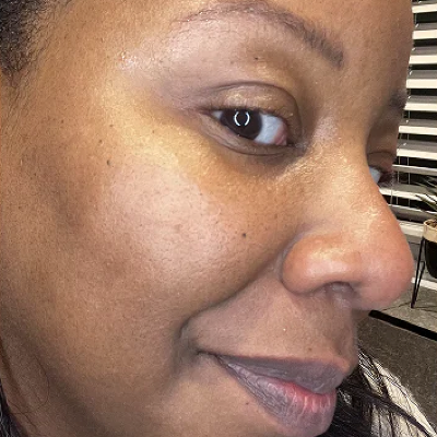 Close-up of a woman's face showing a side profile, highlighting her cheek, nose, and lips. The background shows window blinds and a dark surface.