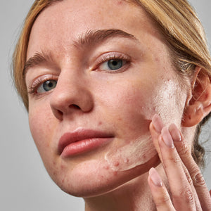 Female model applying Acne Clearing Moisturizer to her face