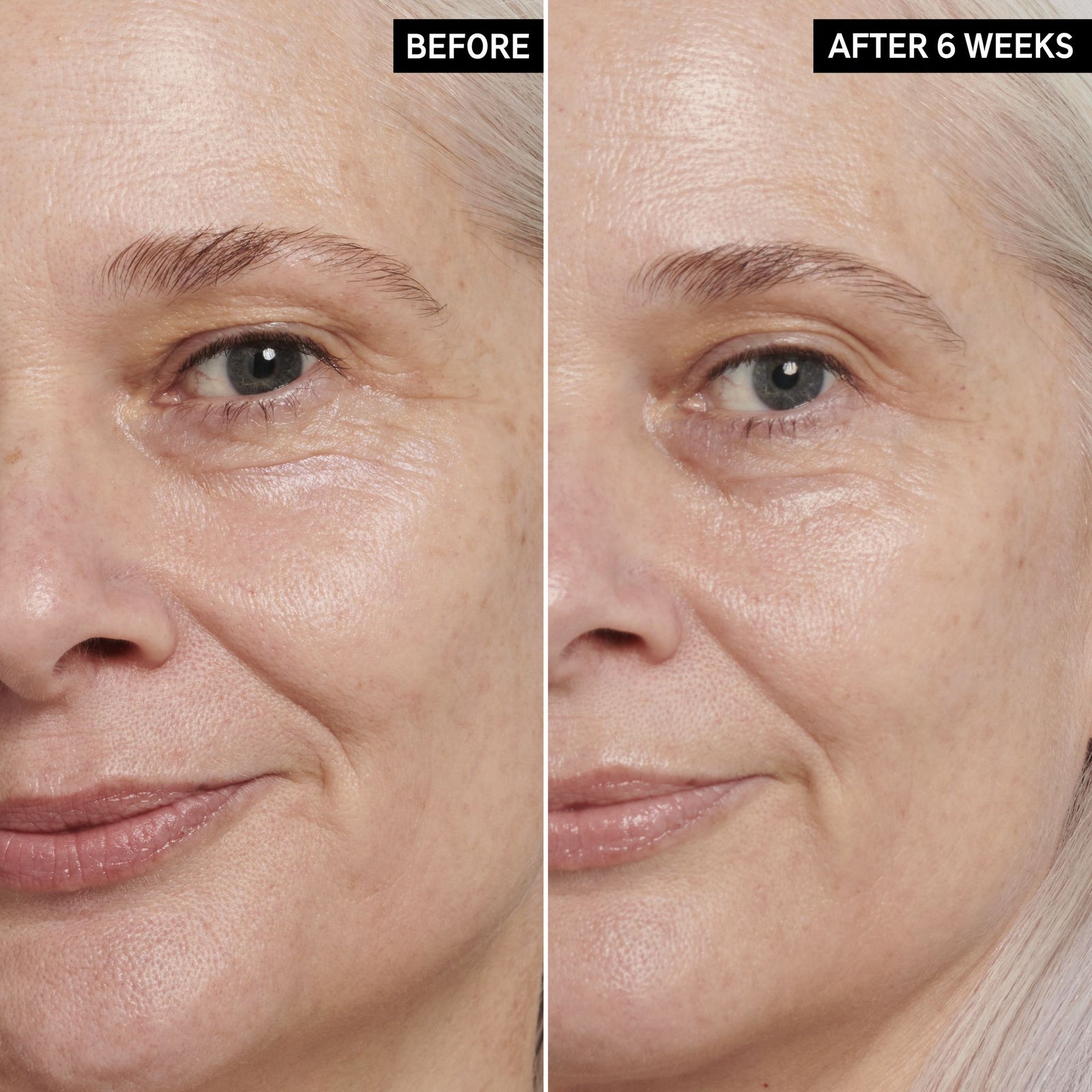 Two images of a mature female model's face side by side to show before and after using Retinol Eye Cream