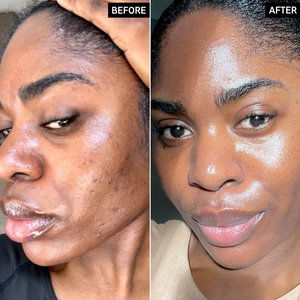 Before and After of customer using Omega Water Cream