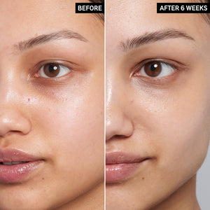 2 photos of model's face next to eachother to show before and after using Caffeine Eye Cream