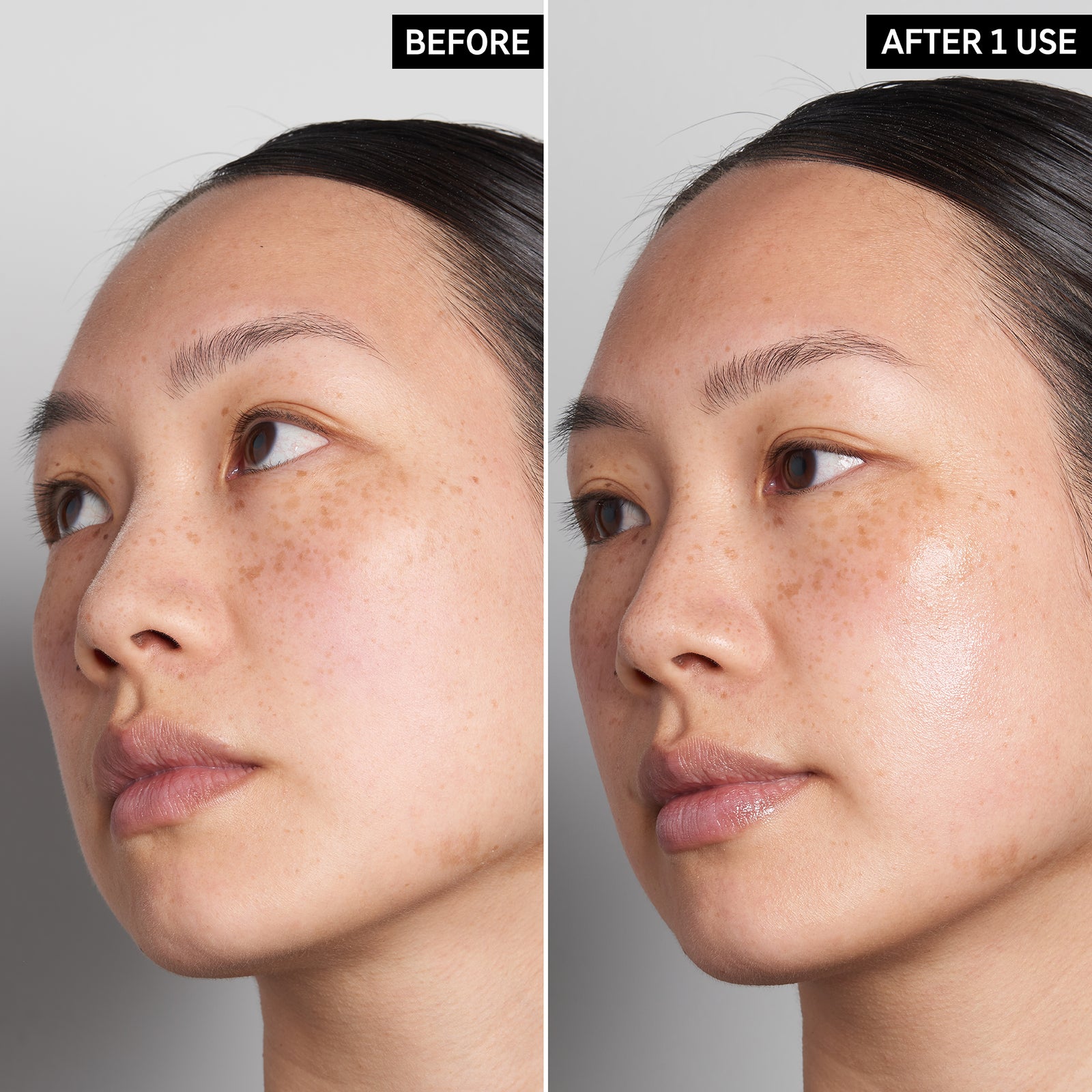 Two photos of a model's face next to eachother to show the before and after of using Hyaluronic Acid Serum