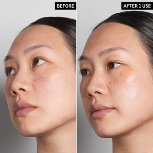Two photos of a model's face next to eachother to show the before and after of using Hyaluronic Acid Serum