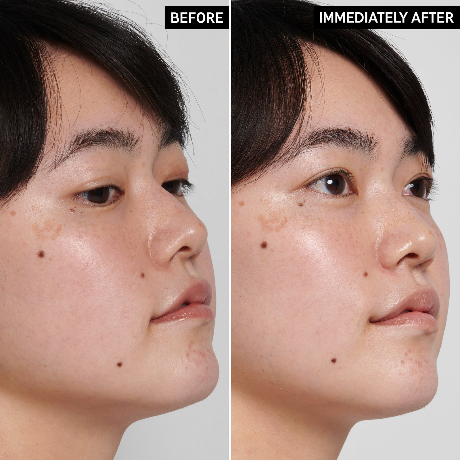 Two images of a model's face side by side to show before and after using Hyaluronic Acid Cleanser