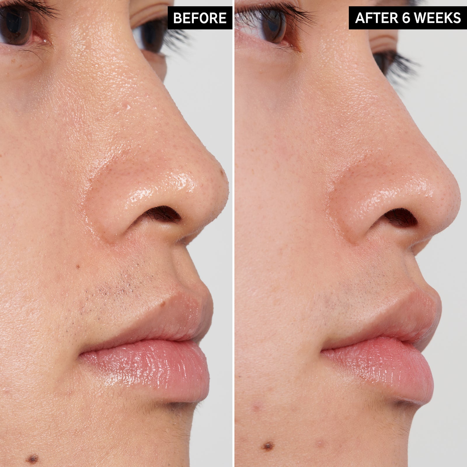 Two images of a model's face side by side to show before and after using PHA Toner for 6 weeks