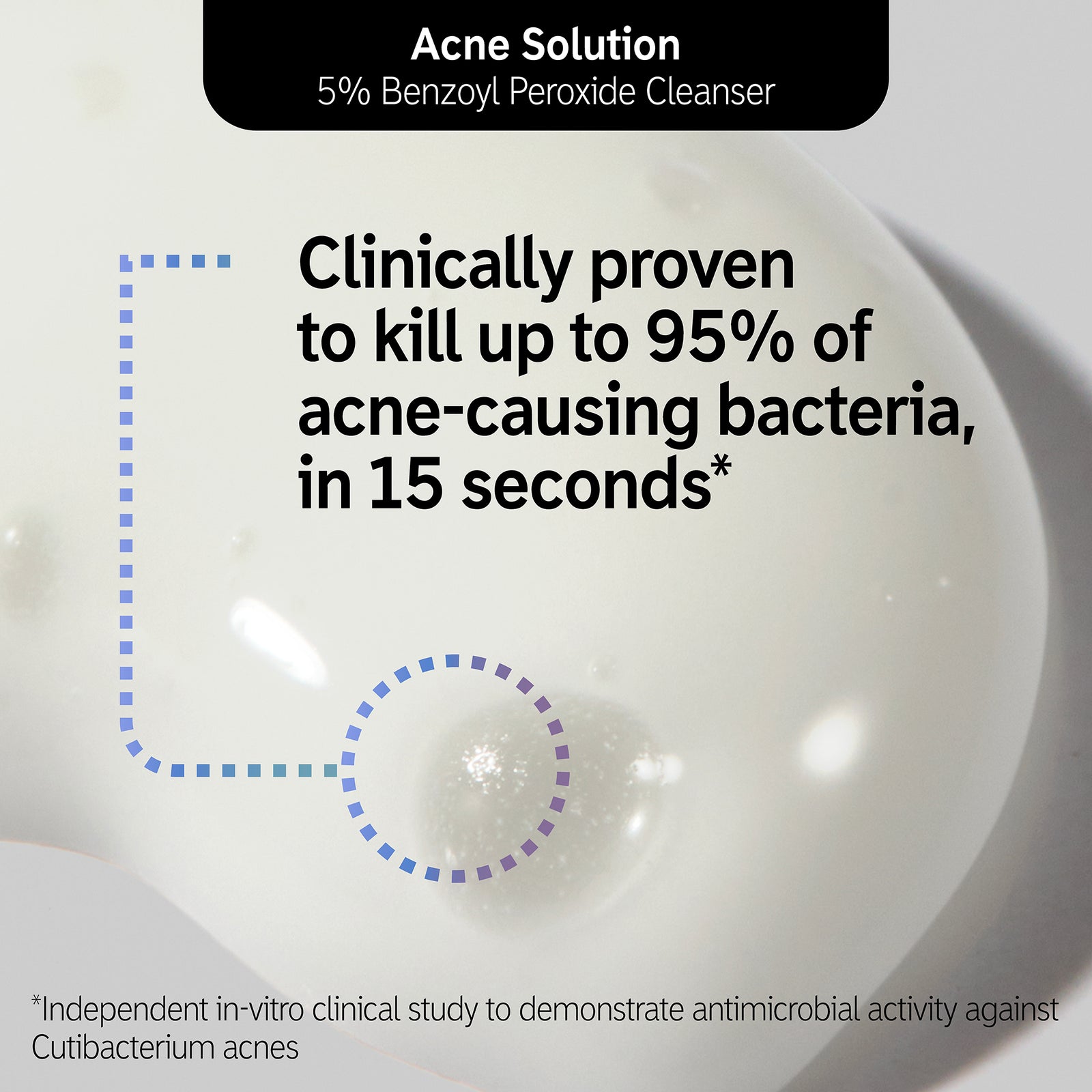 Acne Solution goop shot annotated with a statistic about killing bacteria